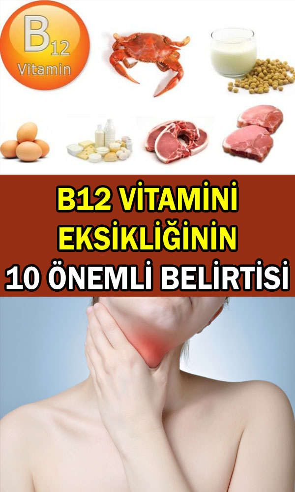 b12 vitamini eksikliği belirtileri