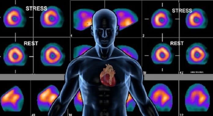 kalp sintigrafisi yan etkileri ve risleri